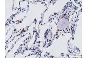 Immunohistochemical staining of paraffin-embedded Human lung tissue using anti-PECR mouse monoclonal antibody. (PECR antibody)