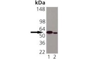 Western blot analysis of Calreticulin: Lane 1: HeLa (Heat Shocked), Lane 2: Vero. (Calreticulin antibody)