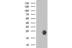 Image no. 1 for anti-Transmembrane Emp24 Protein Transport Domain Containing 1 (TMED1) antibody (ABIN1501414) (TMED1 antibody)
