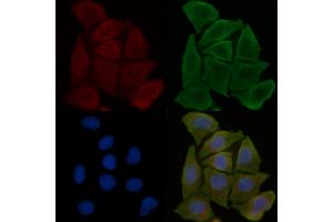 ABIN6258319 and ABIN6275775 staining Hela cells(30 min of UV treatment) by IF/ICC. (IFIT5 antibody  (Internal Region))