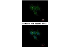 ICC/IF Image Immunofluorescence analysis of methanol-fixed Hep3B, using GSTA1, antibody at 1:500 dilution. (GSTA1 antibody)