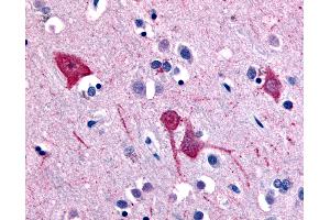 Solute Carrier Family 5 (Sodium/inositol Cotransporter), Member 11 (SLC5A11) (Extracellular Domain) antibody