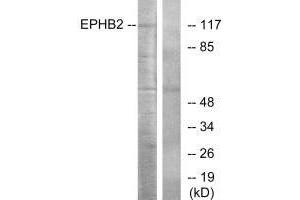 Western blot analysis of extracts from Jurkat cells, using EPHB2 antibody. (EPH Receptor B2 antibody  (C-Term))