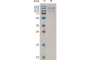 SDS-PAGE (SDS) image for CD248 Molecule, Endosialin (CD248) (AA 18-685) protein (His tag) (ABIN7490823)
