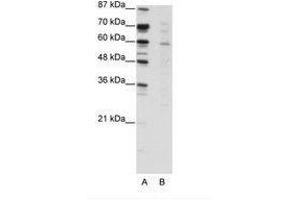 Image no. 1 for anti-Core-binding Factor, Runt Domain, alpha Subunit 2, Translocated To, 3 (CBFA2T3) (N-Term) antibody (ABIN203203) (CBFA2T3 antibody  (N-Term))