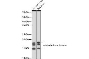 Western blot analysis of extracts of various cell lines, using Myelin Basic Protein antibody (ABIN3022348, ABIN3022349, ABIN3022350 and ABIN6218754) at 1:1000 dilution. (MBP antibody  (AA 1-197))