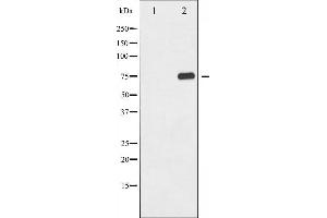 Western Blotting (WB) image for anti-Nuclear Factor-kB p65 (NFkBP65) (pThr435) antibody (ABIN6255688)