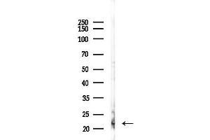 anti-MpV17 Mitochondrial Inner Membrane Protein (MPV17) (Internal Region) antibody