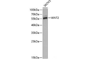 Western blot analysis of extracts of SKOV3 cells using WNT2 Polyclonal Antibody at dilution of 1:1000. (WNT2 antibody)