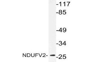 Western blot (WB) analysis of NDUFV2 antibody in extracts from Jurkat cells. (NDUFV2 antibody)