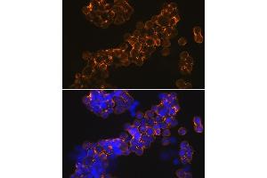 Immunofluorescence analysis of MCF-7 cells using NMD Rabbit mAb (ABIN7267417) at dilution of 1:100 (40x lens). (GRIN1/NMDAR1 antibody)
