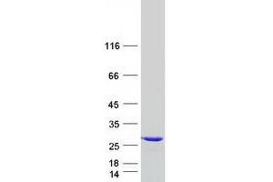 RAB11B Protein (Myc-DYKDDDDK Tag)