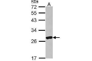 WB Image Sample (30 ug of whole cell lysate) A: IMR32 12% SDS PAGE antibody diluted at 1:500 (ARHGDIA antibody)