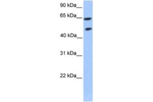 Western Blotting (WB) image for anti-Zinc Finger Protein 449 (ZNF449) antibody (ABIN2460260) (ZNF449 antibody)