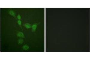 Immunofluorescence analysis of A549 cells, using PKA alpha/beta CAT (Ab-197) Antibody. (PKA alpha/beta Cat (AA 166-215) antibody)