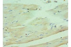 Immunohistochemistry of paraffin-embedded human skeletal muscle tissue using ABIN7148336 at dilution of 1:100 (C1QB antibody  (AA 104-253))