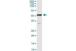 BACE1 monoclonal antibody (M02), clone 2C1. (BACE1 antibody  (AA 22-501))
