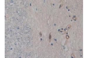 Detection of FABP9 in Rat Spinal cord Tissue using Polyclonal Antibody to Fatty Acid Binding Protein 9, Testis (FABP9) (FABP9 antibody  (AA 1-130))