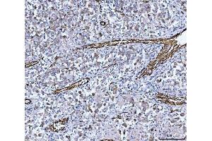 IHC analysis of PTRF/CAVIN1 using anti-PTRF/CAVIN1 antibody (ABIN7601817).