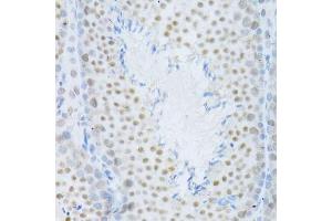 Immunohistochemistry (Paraffin-embedded Sections) (IHC (p)) image for anti-Mitogen-Activated Protein Kinase 3 (MAPK3) (AA 1-100) antibody (ABIN3020725)