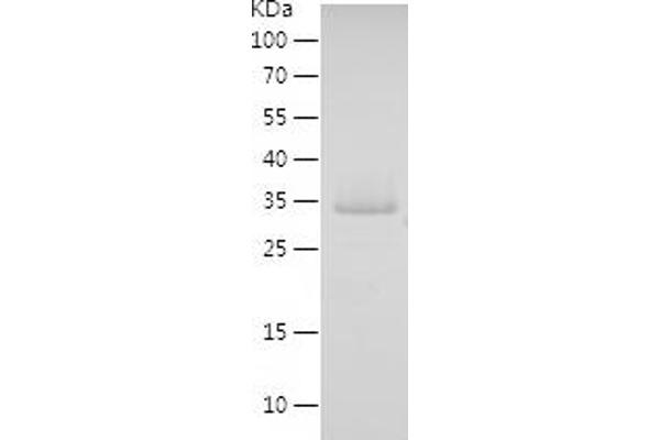 FBLIM1 Protein (AA 1-200) (His tag)