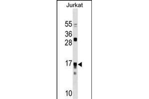 IL17RC Antibody (N-term) (ABIN1538937 and ABIN2850039) western blot analysis in Jurkat cell line lysates (35 μg/lane). (IL17RC antibody  (N-Term))