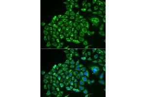 Immunofluorescence analysis of MCF-7 cells using RCVRN antibody. (Recoverin antibody)