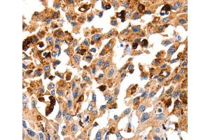 Immunohistochemistry (IHC) image for anti-Cathepsin B (CTSB) antibody (ABIN2427899) (Cathepsin B antibody)