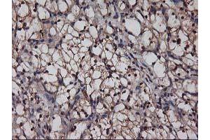 Image no. 7 for anti-V-Akt Murine Thymoma Viral Oncogene Homolog 1 (AKT1) antibody (ABIN1496558) (AKT1 antibody)