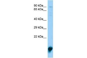Host:  Rabbit  Target Name:  Pla2g12a  Sample Type:  Rat Spleen lysates  Antibody Dilution:  1. (PLA2G12A antibody  (Middle Region))