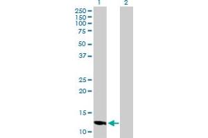 Western Blot analysis of LOC494141 expression in transfected 293T cell line by LOC494141 MaxPab polyclonal antibody. (SLC25A51P4 antibody  (AA 1-154))