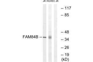 Western blot analysis of extracts from Jurkat cells and HUVEC cells, using FAM84B antibody. (FAM84B antibody  (N-Term))