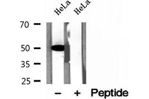 Western blot analysis of extracts of HeLa cells, using GLUD1 antibody. (GLUD1 antibody  (Internal Region))