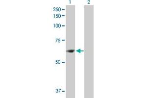 Western Blot analysis of ZNF599 expression in transfected 293T cell line by ZNF599 MaxPab polyclonal antibody. (ZNF599 antibody  (AA 1-588))