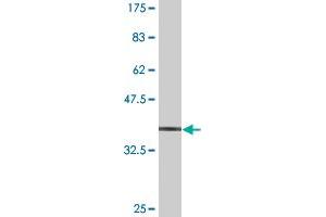 Western Blot detection against Immunogen (37. (MPHOSPH9 antibody  (AA 922-1031))