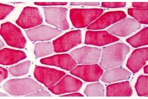 Human Skeletal Muscle: Formalin-Fixed, Paraffin-Embedded (FFPE) (TNNI2 antibody)