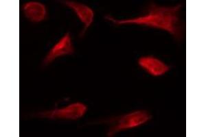 ABIN6267350 staining MCF7 by IF/ICC. (Bcl-2 antibody  (pSer87))