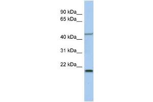 WB Suggested Anti-KLF15 Antibody Titration:  0. (KLF15 antibody  (Middle Region))