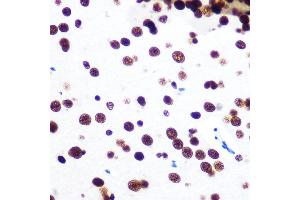 Immunohistochemistry (IHC) image for anti-Splicing Factor Proline/glutamine-Ric (SFPQ) antibody (ABIN7270547)