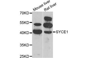 Western blot analysis of extracts of mouse liver and rat liver cell lines, using SYCE1 antibody.