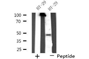 SERPINA11 antibody  (N-Term)