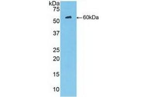 Detection of Recombinant MBL, Human using Polyclonal Antibody to Mannose Binding Lectin (MBL) (MBL2 antibody  (AA 130-248))