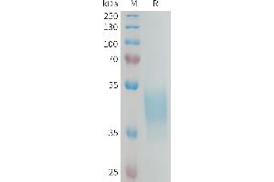 KIR2DL3 Protein (AA 22-245) (His tag)