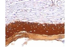 Immunohistochemical staining (Formalin-fixed paraffin-embedded sections) analysis of human skin with Pan Cytokeratin monoclonal antibody, clone AE1 + AE3  at 1:200 using peroxidase-conjugate and DAB chromogen. (Keratin 77 antibody)