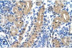 Immunohistochemical staining (Formalin-fixed paraffin-embedded sections) of human kidney with HSD17B1 polyclonal antibody  at 4-8 ug/mL working concentration. (HSD17B1 antibody  (N-Term))