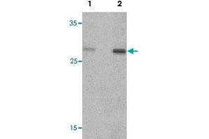 Western blot analysis of rat spleen tissue lysate with CLEC7A polyclonal antibody  at (1) 1 and (2) 2 ug/mL.