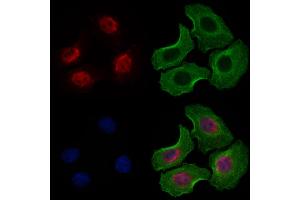ABIN6263656 and ABIN6277487 staining Hela cells by IF/ICC. (Nemo-Like Kinase antibody  (N-Term))