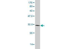 Western Blot detection against Immunogen (32. (LMO3 antibody  (AA 91-146))