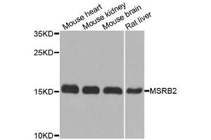 Western blot analysis of extracts of various cell lines, using MSRB2 antibody. (MSRB2 antibody  (AA 10-182))