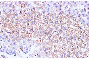 Immunohistochemistry of paraffin-embedded Mouse liver using GCK Polyclonal Antibody at dilution of 1:100 (GCK antibody)